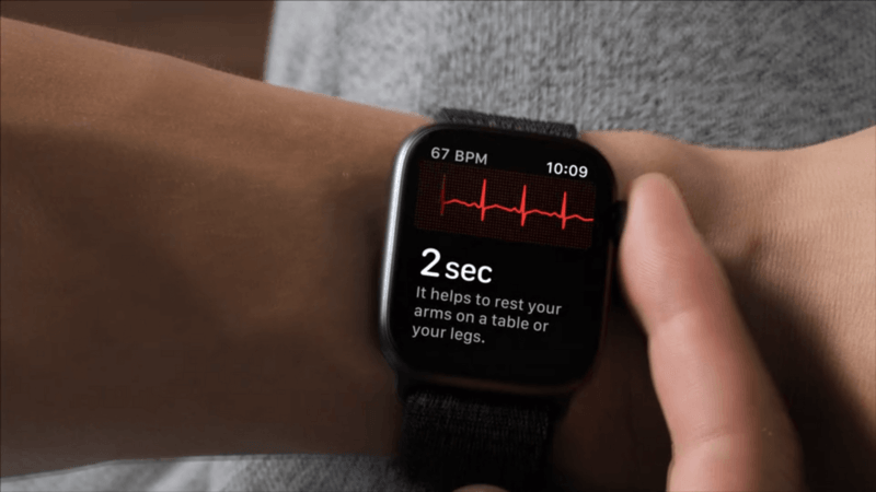 Функция снятия ЭКГ появится в Apple Watch Series 4 до конца года